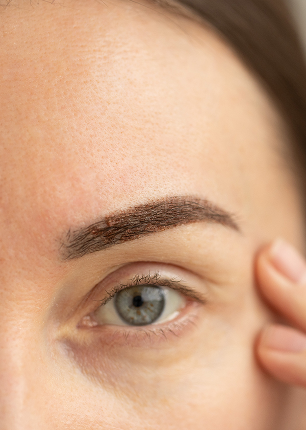 Eyebrow Hair Transplants